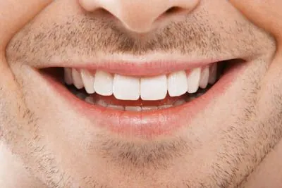 closeup of a man's smile after a smile makeover at Ember Dental Arts